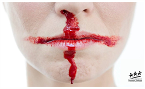 An image of the bottom of a woman's face with blood dripping from her mouth and nose to resemble the England flag
